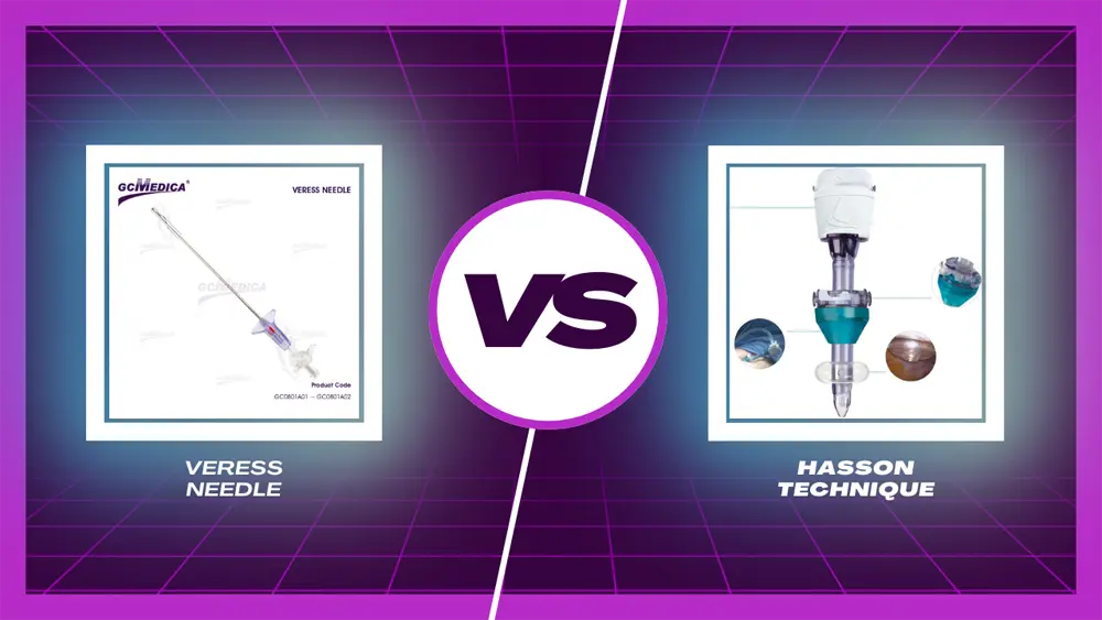 Veress Needle vs. Hasson Technique